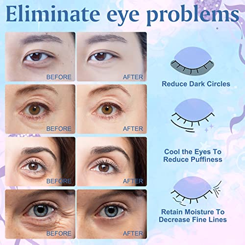 Rtewxlp מתחת למסכת עיניים רפידות ג'ל, מתחת לטלאי עיניים לעיניים נפוחות, עיגולים כהים ונפיחות, טיפול בשקיות עיניים קולגן ימיות טבעיות,
